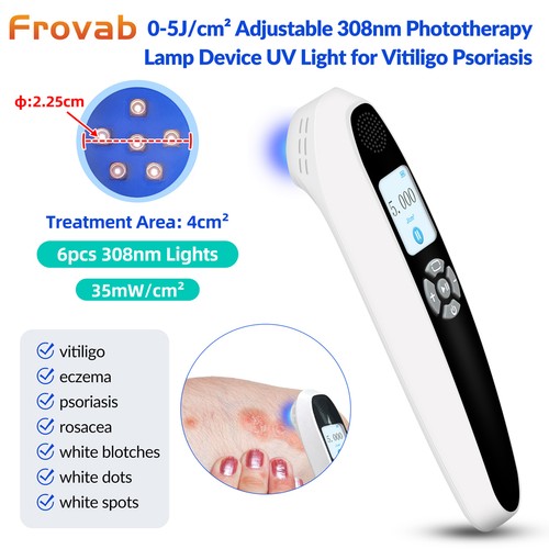 Handheld 308nm narrowband uvb - 308nm,
