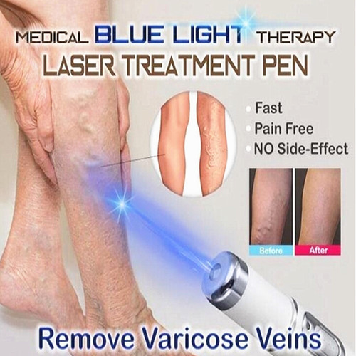 Medical blue light - medical,