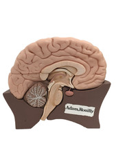 Adam Rouilly Model of Half Brain Separates Into 4 Parts Missing Stand Used F1
