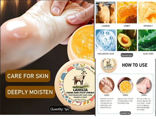 Lanolin cream for cracked - cream,