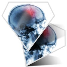 2 x Diamond Stickers 7.5 cm - Stroke Victim Skull X Ray Medical Doctor  #24213