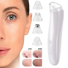 Electric Blackhead Remover Vacuum Pore Nose Sucker Pimple Skin Acne Face Cleaner
