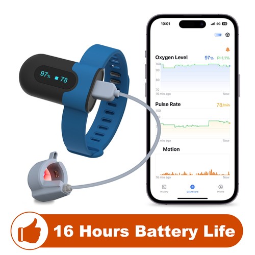 Wellue sleepu continuous wrist - sleepu,