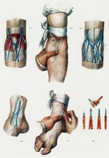 ML17 Vintage 1800's Medical