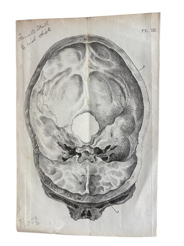 19thc lithograph female skull - lithograph,