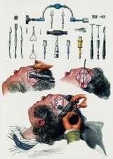 Ml22 vintage 1800 medical - vintage,