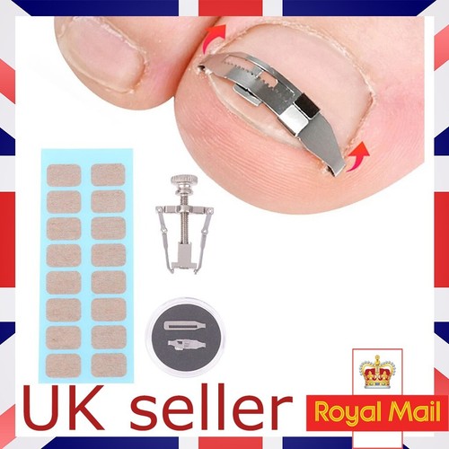 Ingrown toenail corrector - toenail,