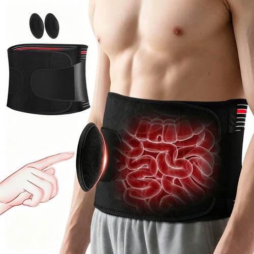 Nhs umbilical hernia - hernia, support