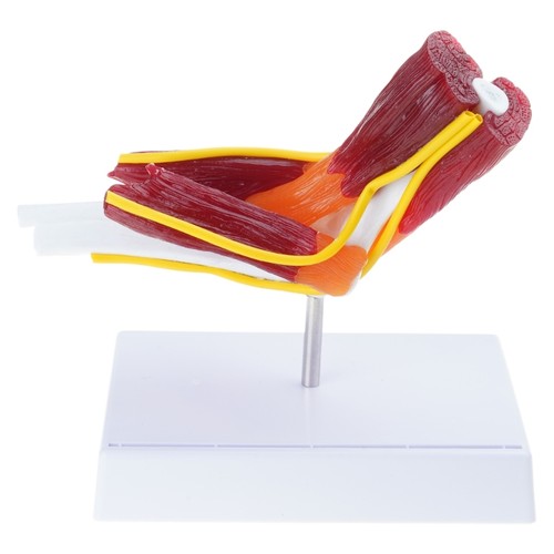 Anatomical elbow joint and - elbow,