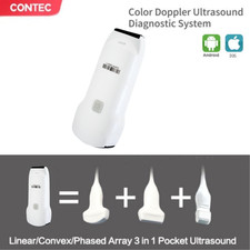 Handheld Ultrasound Scanner
