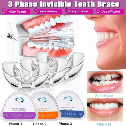Stages dental orthodontic - 3,