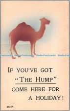 R517400 If You ve Got The Hump