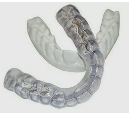 Custom dental essix - dental, retainer