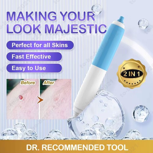 Natural painless auto skin tag - auto,
