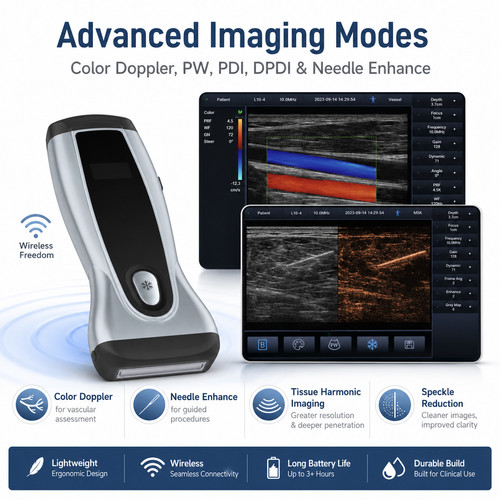 Wireless ultrasound - 3-in-1,
