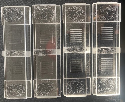 Mcmaster worm egg counting - 4,
