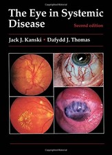 The Eye in Systemic Disease (Colour..., Thomas, Dafydd 