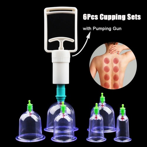 6pcs vacuum cupping - 6pcs,