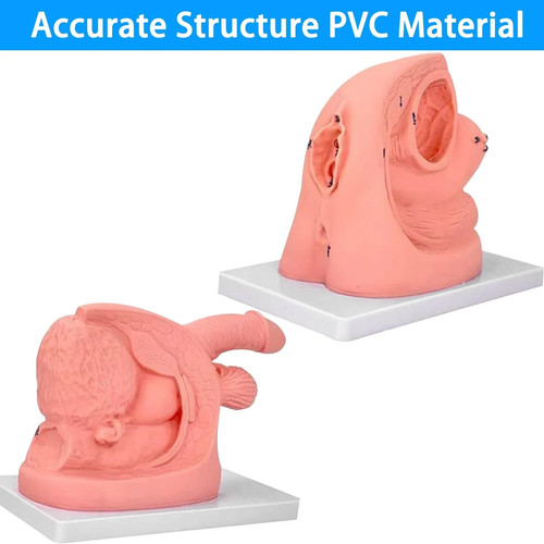 Male female urethral - male,
