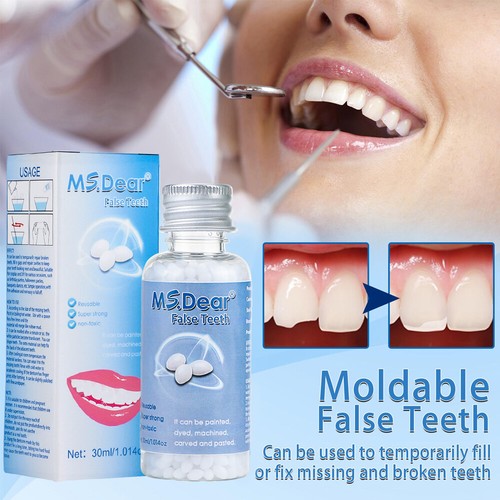 Moldable teeth tooth - tooth, repair