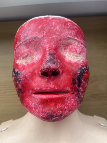 Burns face resusci anne - burns, to