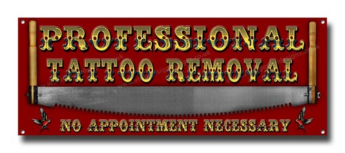 Professional tattoo removal - tattoo,