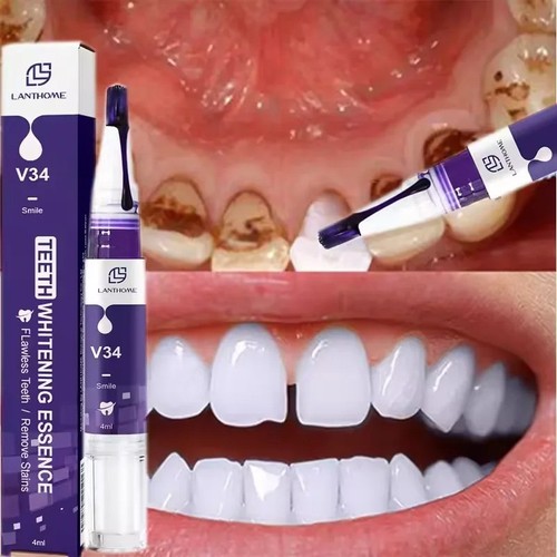 Teeth whitening essence whiten - teeth,
