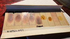 Set of 9 Prepared Histology Microscope Slides - Like Dexter's Blood Film Slides!