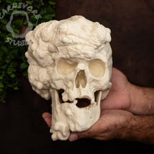 Joseph Merrick Skull Replica