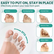 Bunion Correction Hammer Toe
