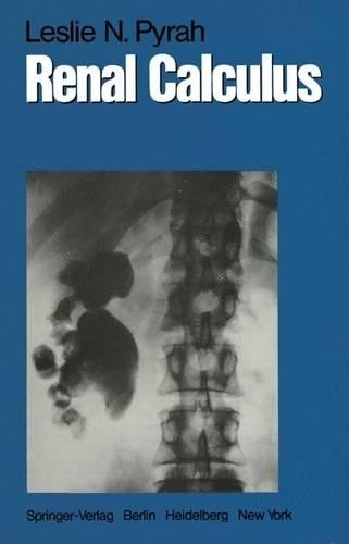Renal calculus leslie - calculus, n