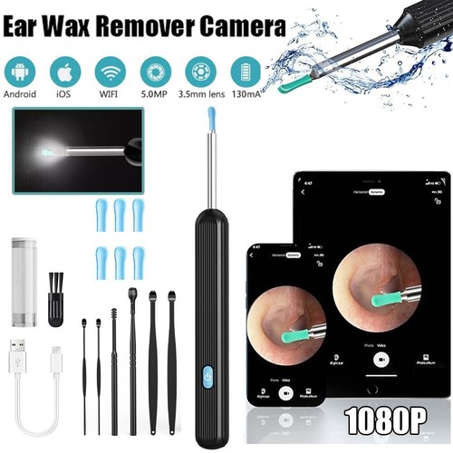 1080p ear wax remover - remover, kit