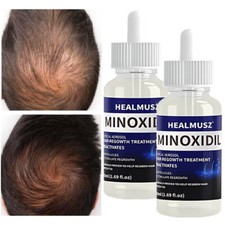 5% Minoxidil for Men&Women