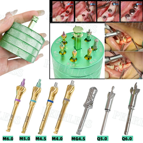 Dental bone profiler ridge - dental,
