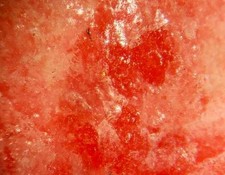 TUGTUPITE, BERRYLLITE - Type Locality - Kvanefjeld, GREENLAND