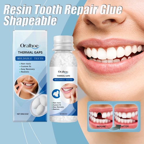 Teeth glue for loose - teeth,