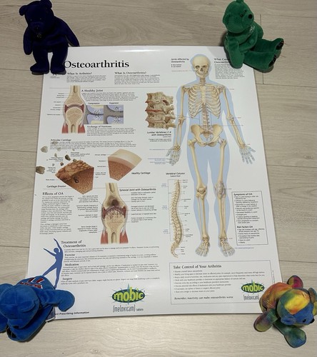 Mobic osteoarthritis medical - osteoarthritis,