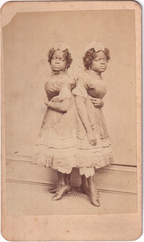 Siamese twins mccoy sisters - twins,,