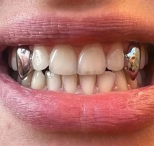 Custom Fit Silver Mouth Grillz