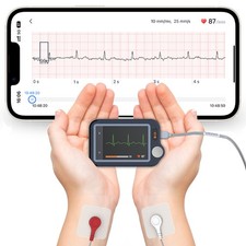 Home ECG Monitor with External