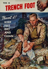 2W48 Vintage WWII This Is Trench Foot Wartime Health War Poster WW2 A4