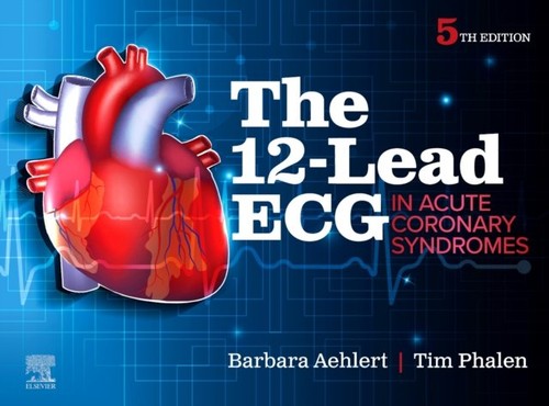 The lead ecg - in, acute