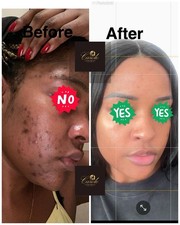 Extra Whitening Face Treatment 