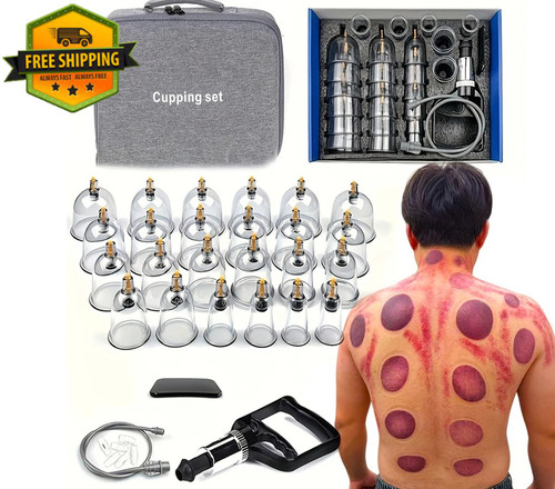 24pcs vacuum cupping - 24pcs,