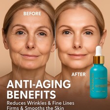 Ammuri Retinol Serum 5% Max
