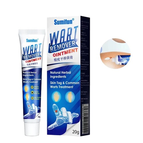 Sumifun wart removal body - sumifun,