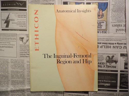 Ethicon the inguinal femoral - ethicon, inguinal-femoral