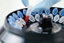 Eppendorf™ Safe-Lock Tubes