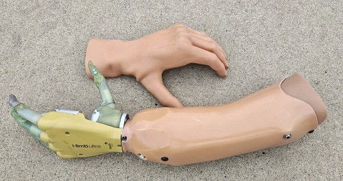 Ottobock touch bionics limb - bionics, i-limb