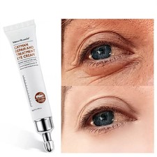 Magic Eye Cream-28 Seconds Instant Remove Eye Bags&dark Circles&eye Wrinkles UK